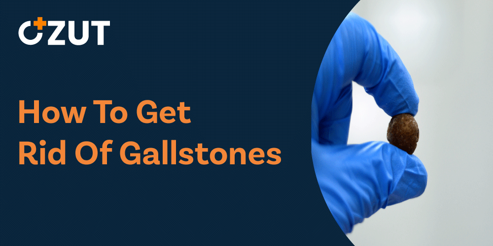 Understanding Gallstones: Symptoms, Causes, and Treatment Options