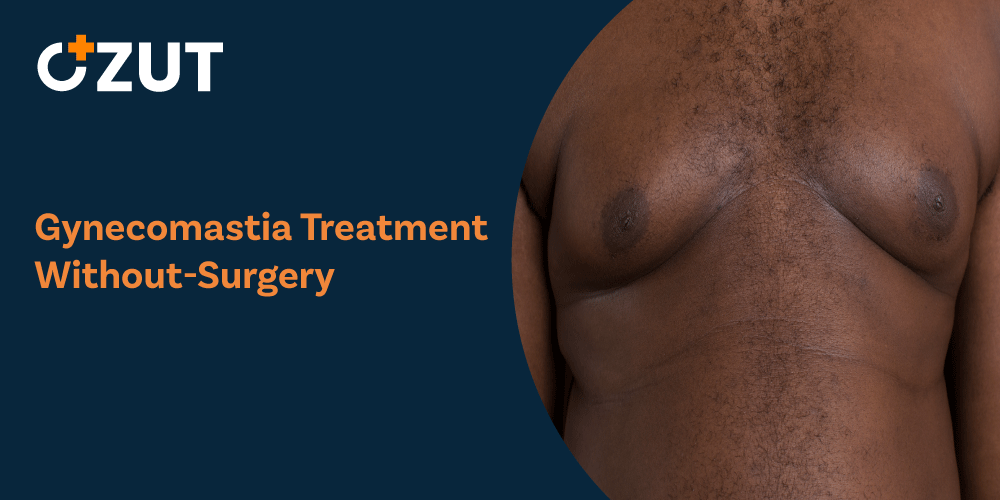 Understanding Gynecomastia: Causes, Treatment Options, and Management Strategies