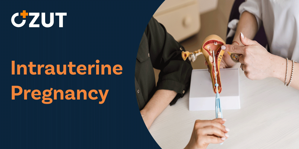 Understanding Intrauterine Pregnancy: Development, Stages, and What to Expect