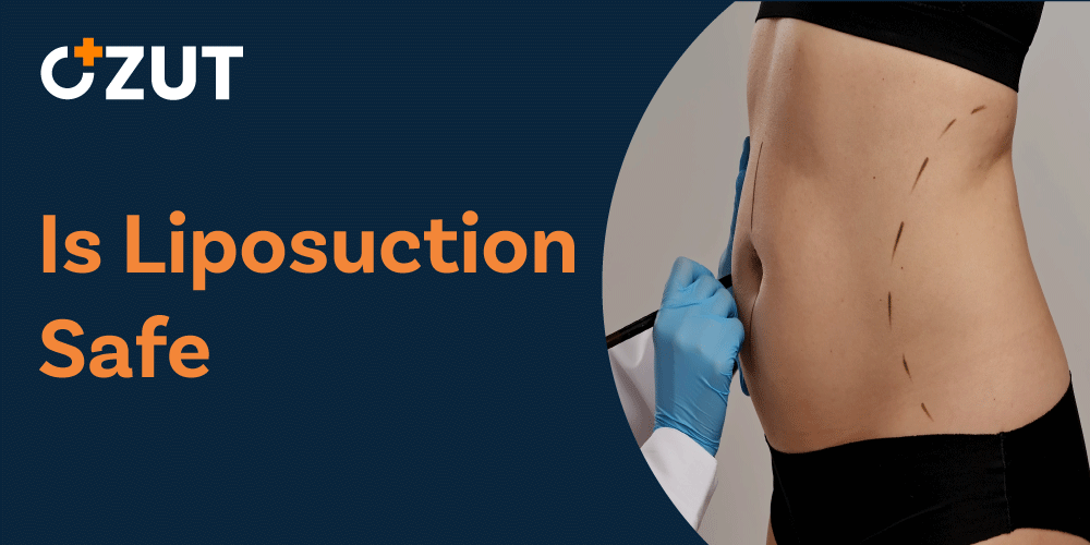 Liposuction: Understanding the Procedure, Recovery, and Risks of Body Contouring