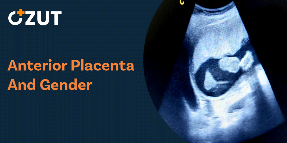 Anterior Placenta and Baby Gender: Separating Fact from Fiction