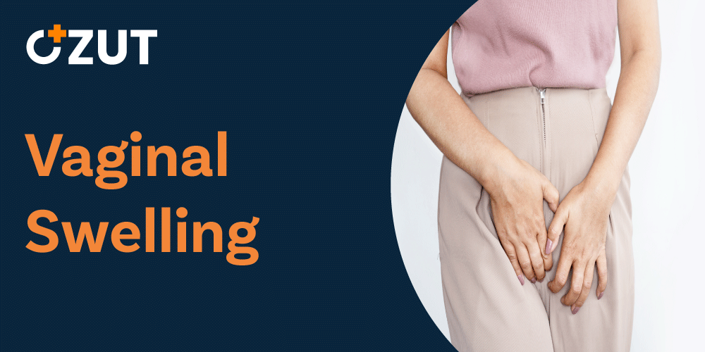 Understanding Vaginal Swelling: Causes, Symptoms, and Treatment Options