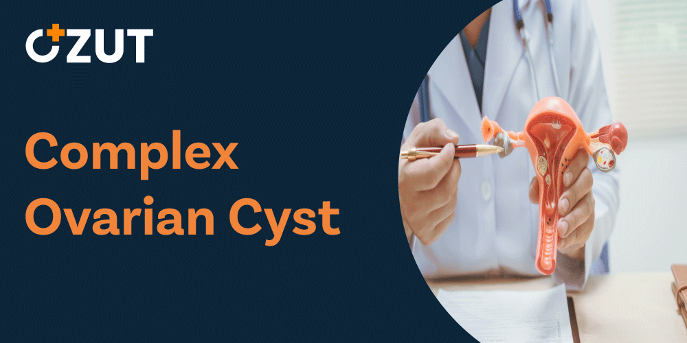 Understanding Ovarian Cysts: Types, Symptoms, Diagnosis, and Treatment Options