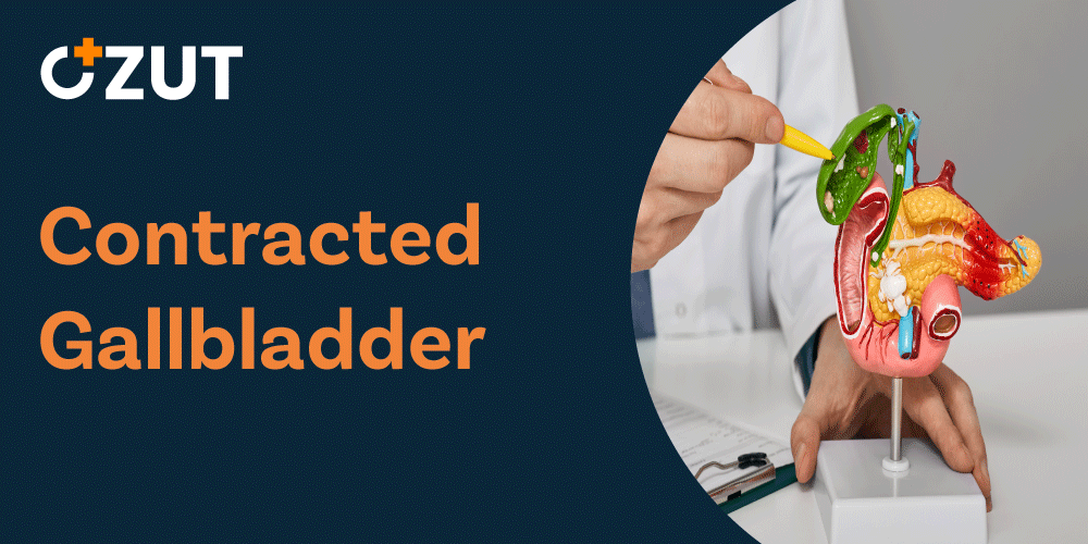 Contracted Gallbladder: Causes, Symptoms, and Treatment Options