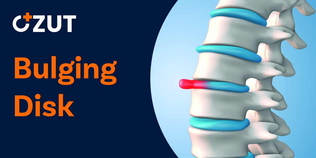 Understanding the Difference Between Bulging Disks and Herniated Disks: Causes, Symptoms, and Impact