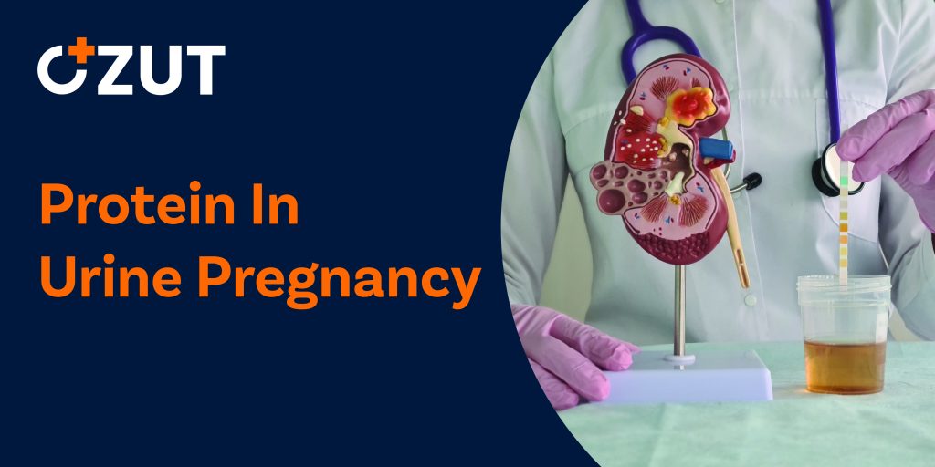 Understanding Protein in Urine During Pregnancy: Causes, Risks, and Treatments
