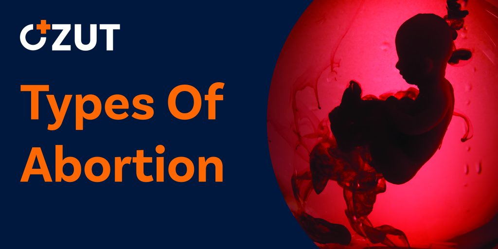 Understanding Abortion Methods: Medication vs. Procedural Options