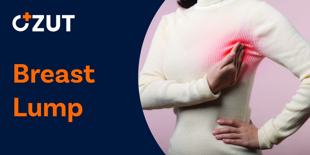 Understanding Breast Lumps and Changes: When to Seek Medical Evaluation