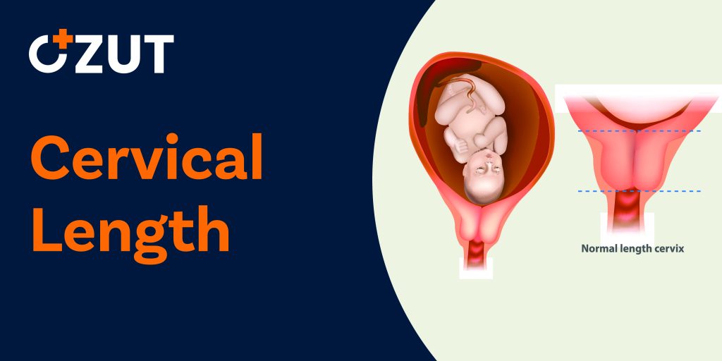 Understanding Cervical Length During Pregnancy: Why It Matters for Maternal and Fetal Health