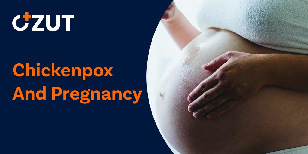 Chickenpox During Pregnancy: Understanding the Risks and Protective Measures