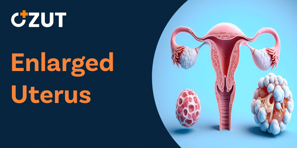 Understanding Enlarged Uterus: Causes, Symptoms, and Treatment Options
