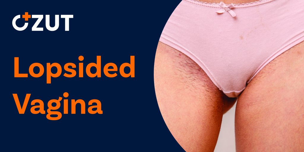 Understanding Labia Variations: A Comprehensive Guide to Vulva Anatomy