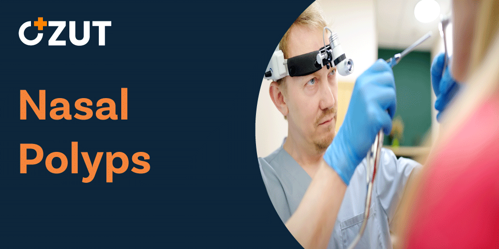 Nasal Polyps: Causes, Symptoms, Diagnosis, and Treatment Options