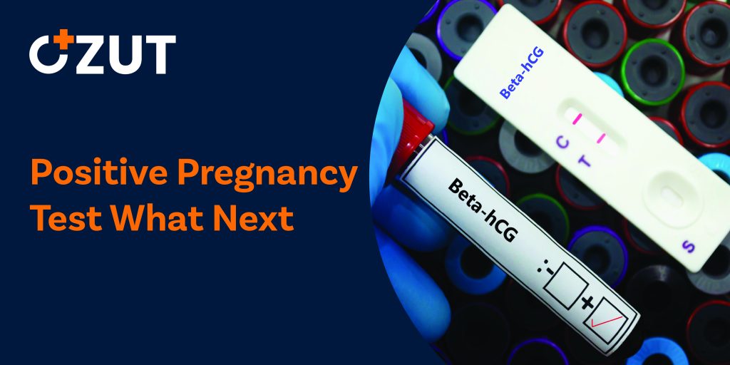 Positive Pregnancy Test: What to Do Next and How to Navigate Early Pregnancy