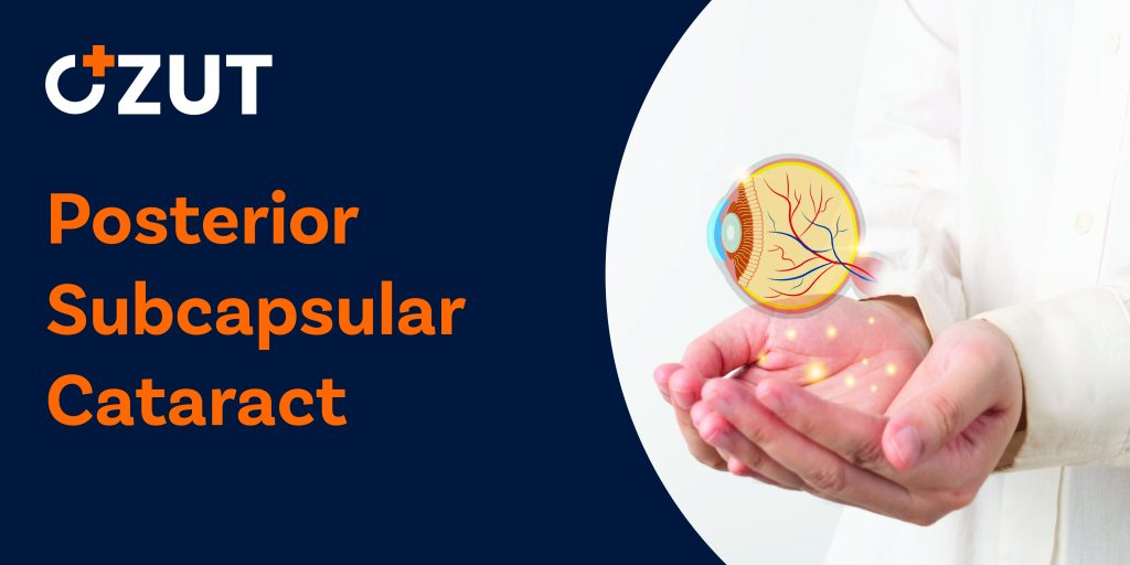 Understanding Posterior Subcapsular Cataracts: Causes, Symptoms, and Treatment Options