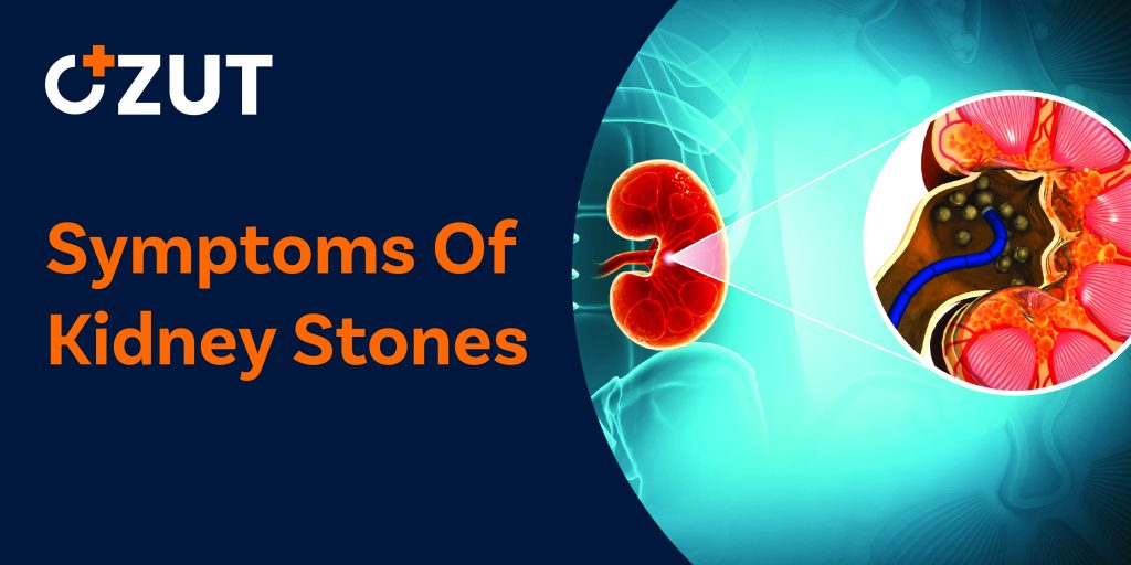 Understanding Kidney Stones: Symptoms, Causes, and When to Seek Help