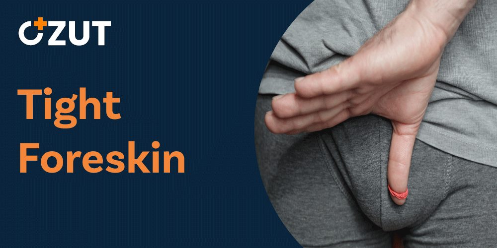 Tight Foreskin: Understanding Phimosis Causes, Symptoms, and Treatment Options