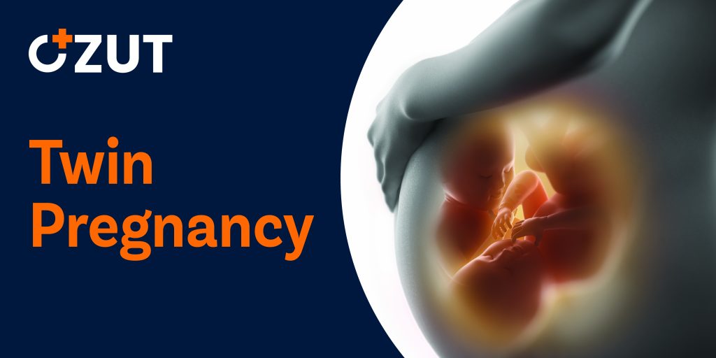 Expecting Multiple Babies: Essential Guide to Twin and Triplet Pregnancy Preparation