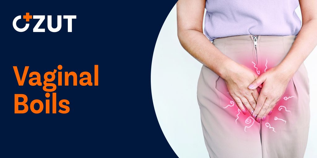 Understanding and Treating Skin Boils in the Groin Area: A Complete Guide