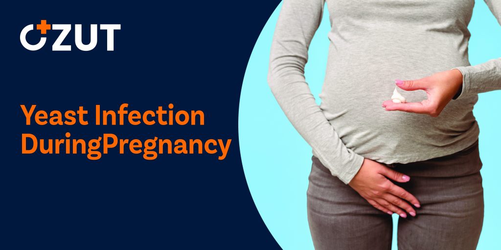 Safe and Effective Treatment Options for Yeast Infections During Pregnancy