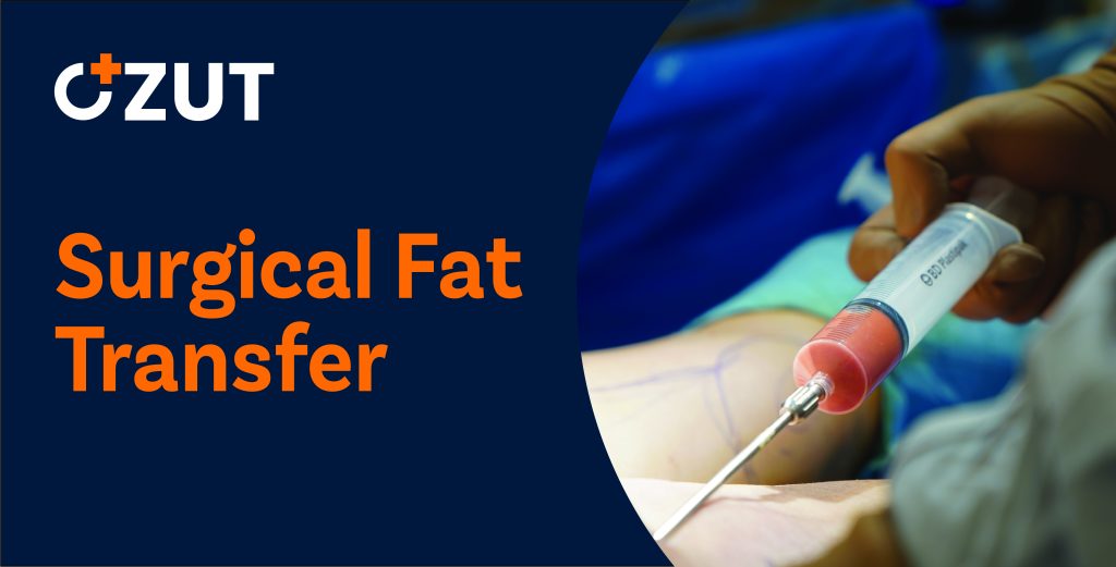 Comprehensive Guide to Surgical Fat Transfer Procedures: What You Need to Know