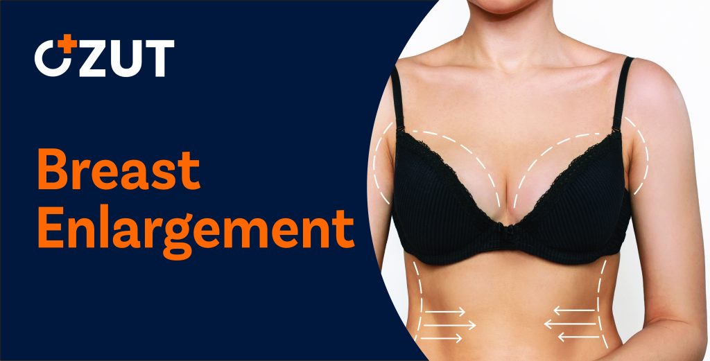 Comprehensive Guide to Breast Augmentation Surgery: What You Need to Know