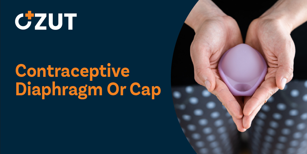 Diaphragm and Cap Contraceptive Methods: Complete Usage Guide