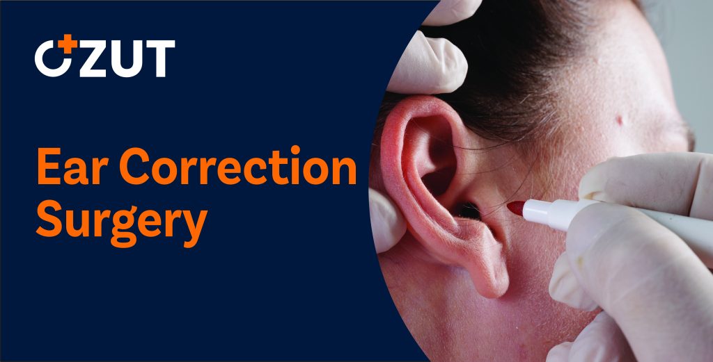 Comprehensive Guide to Ear Correction Surgery: Procedures, Costs, and Recovery