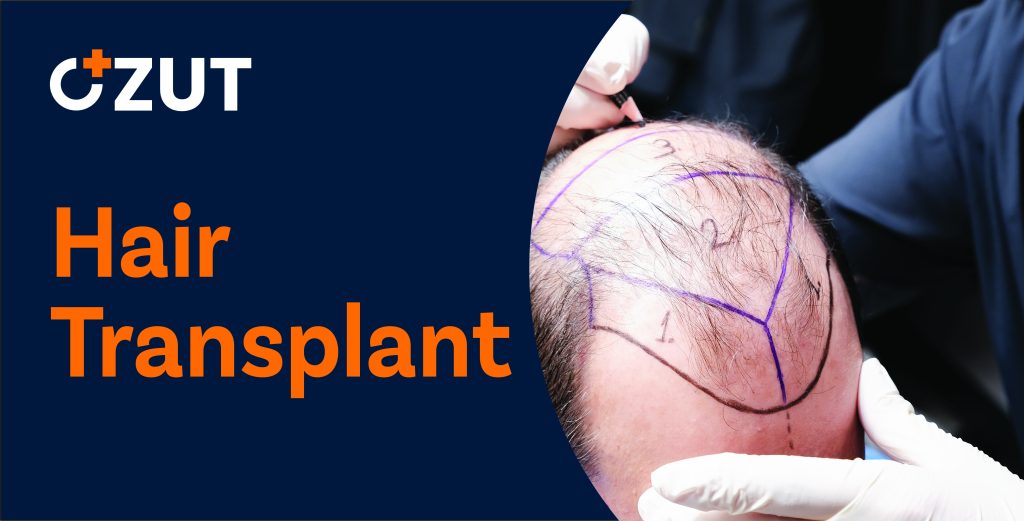 Complete Guide to Hair Restoration Surgery: Procedure, Costs, and Recovery