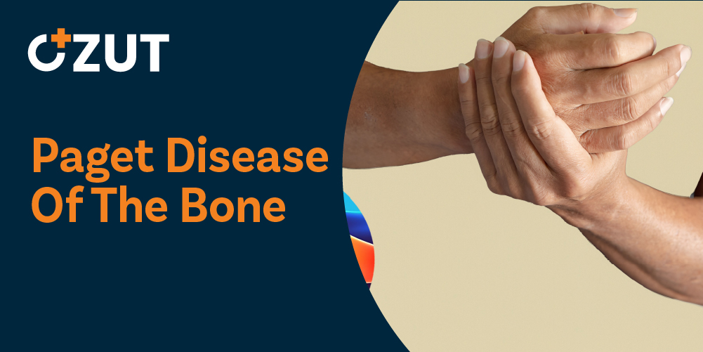 Understanding a Chronic Bone Disorder: Causes, Symptoms, Diagnosis, and Treatment Options