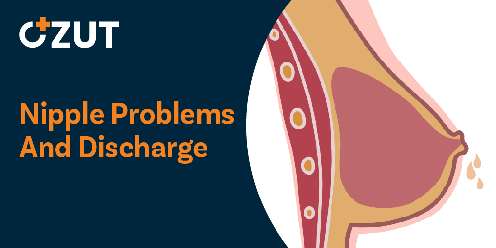 Understanding Common Nipple Conditions and Discharge: A Comprehensive Medical Guide