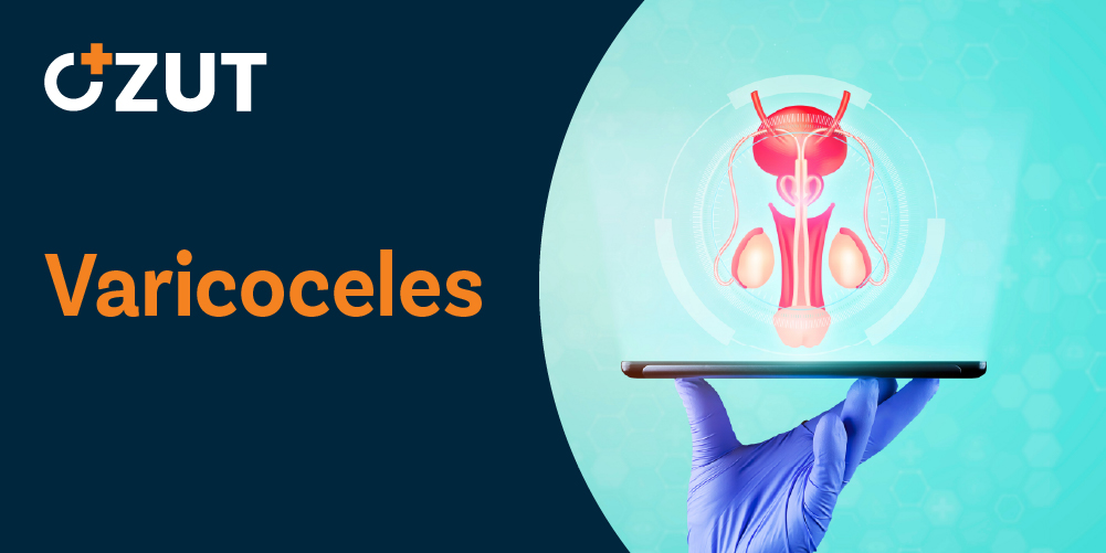 Understanding Varicocele: Causes, Symptoms, Diagnosis, and Treatment Options
