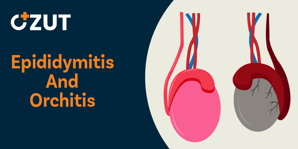 Understanding Testicular and Epididymal Inflammation: Comprehensive Guide to Symptoms, Causes, and Treatment Options