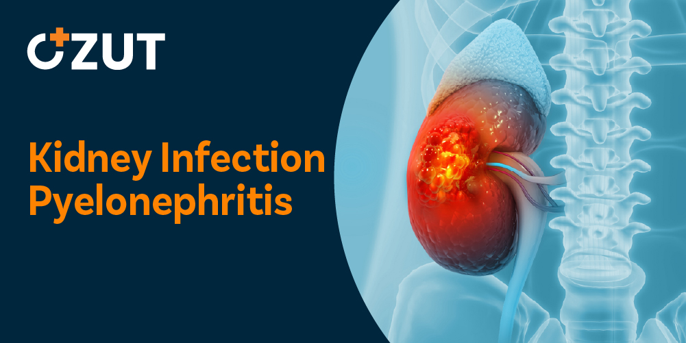 Understanding Kidney Infections: Causes, Symptoms, and Treatment Options