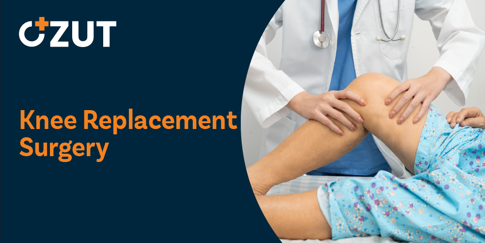 Comprehensive Guide to Knee Replacement Surgery: Procedures, Recovery, and What to Expect