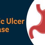 Understanding Digestive Tract Ulcers: Causes, Symptoms, and Diagnostic Approaches