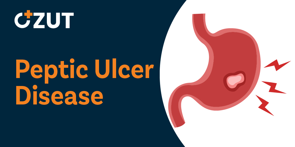 Understanding Digestive Tract Ulcers: Causes, Symptoms, and Diagnostic Approaches