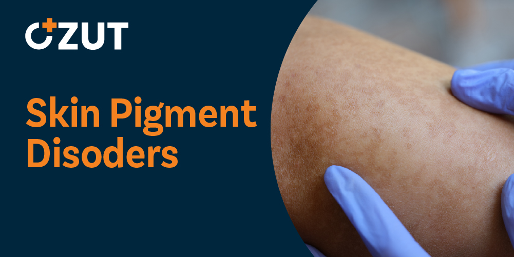 Understanding Skin Pigmentation Changes and Common Disorders
