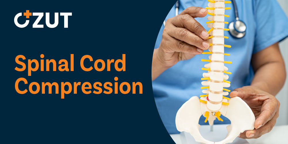 Understanding Spinal Cord Compression: Causes, Symptoms, and Treatment Options