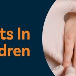 Understanding Skin Warts in Children: Causes, Types, and Treatment Options