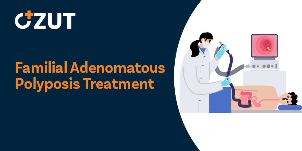Comprehensive Guide to Familial Adenomatous Polyposis Treatment and Surgical Options