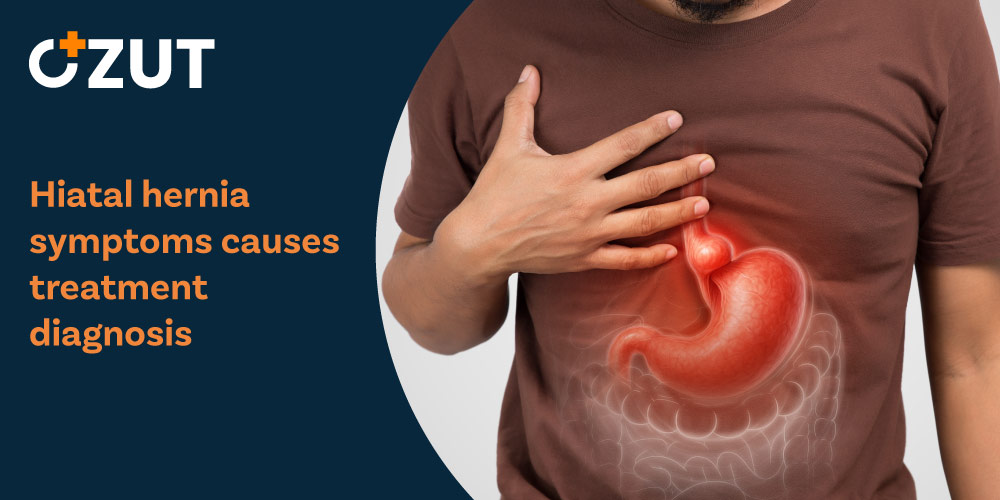 Understanding Hiatal Hernia: Causes, Symptoms, Diagnosis, and Treatment Options