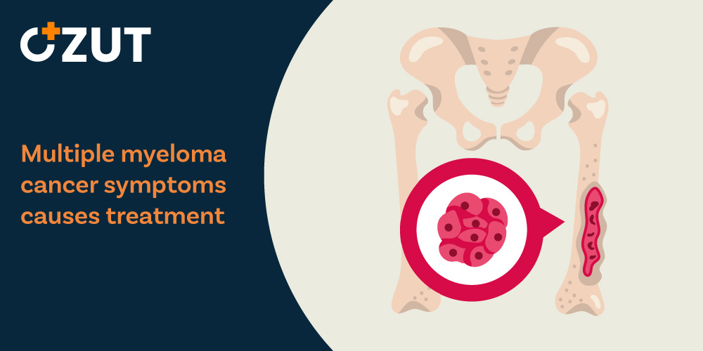 Understanding Multiple Myeloma: Comprehensive Guide to Symptoms, Diagnosis, and Treatment Options