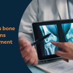 Understanding Bone Density Loss: A Comprehensive Guide to Prevention and Treatment