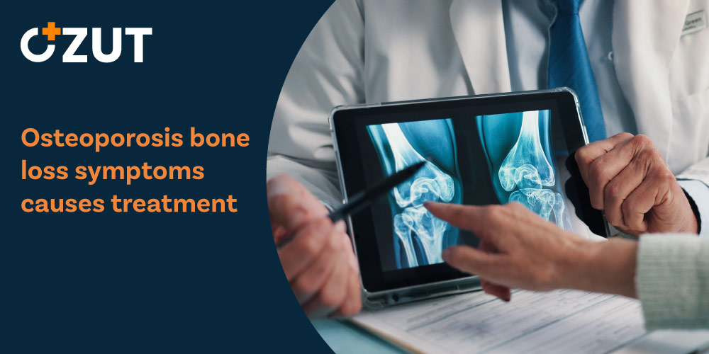 Understanding Bone Density Loss: A Comprehensive Guide to Prevention and Treatment