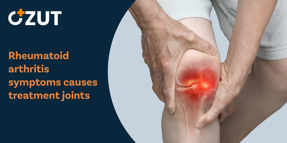 Understanding Autoimmune Joint Disease: Comprehensive Guide to Symptoms, Diagnosis, and Management